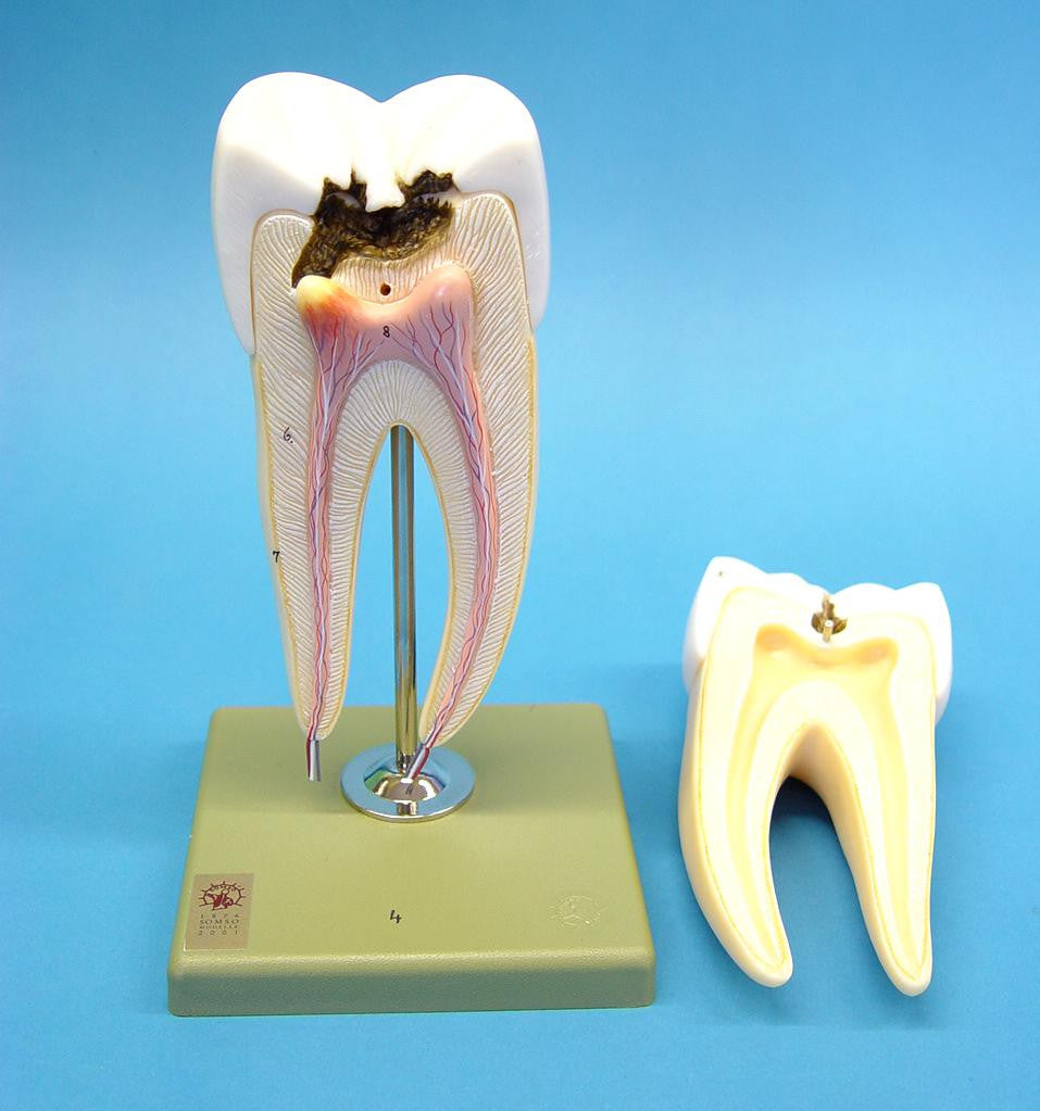 MODEL TOOTH LOWER MOLAR 8x 3P