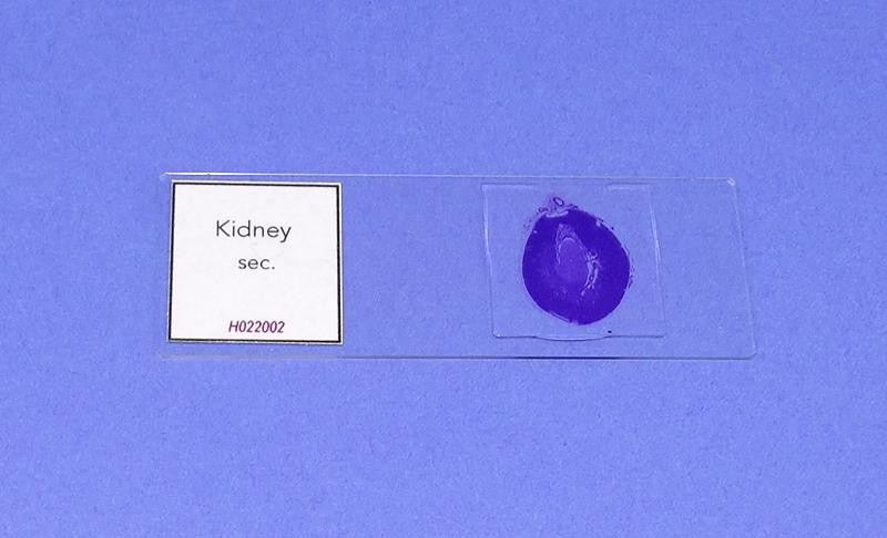 SLIDE P. KIDNEY SEC.