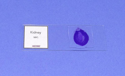 SLIDE P. KIDNEY SEC.