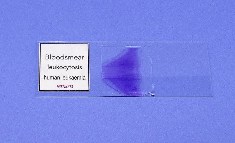 SLIDE P. BLOODSMEAR/LEUCOCYTOS