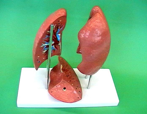 MODEL LUNG  PAIR ON STAND